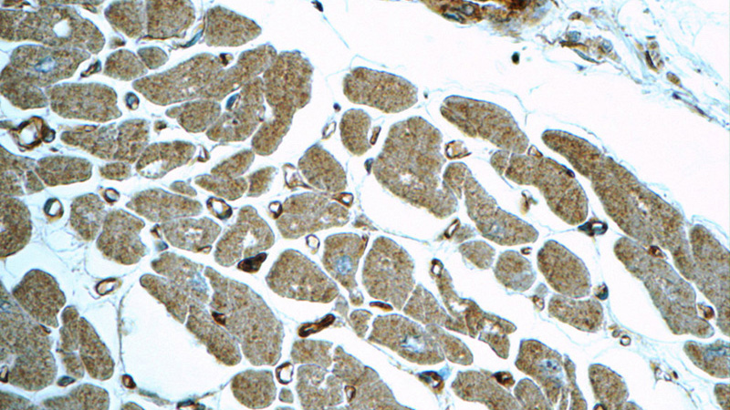 Immunohistochemistry of paraffin-embedded human heart tissue slide using Catalog No:112940(MYL12A Antibody) at dilution of 1:50 (under 40x lens)