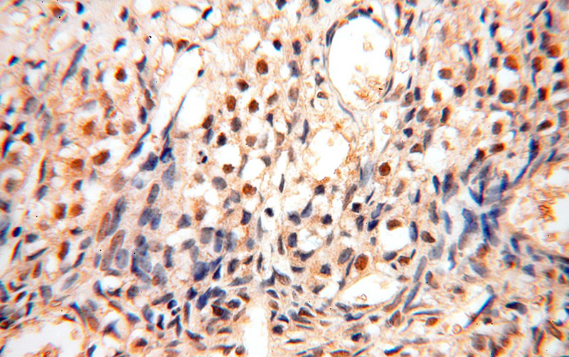 Immunohistochemical of paraffin-embedded human ovary using Catalog No:115856(TASP1 antibody) at dilution of 1:100 (under 40x lens)