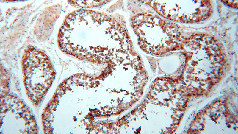 Immunohistochemical of paraffin-embedded human testis using Catalog No:110364(ERLIN1 antibody) at dilution of 1:100 (under 10x lens)