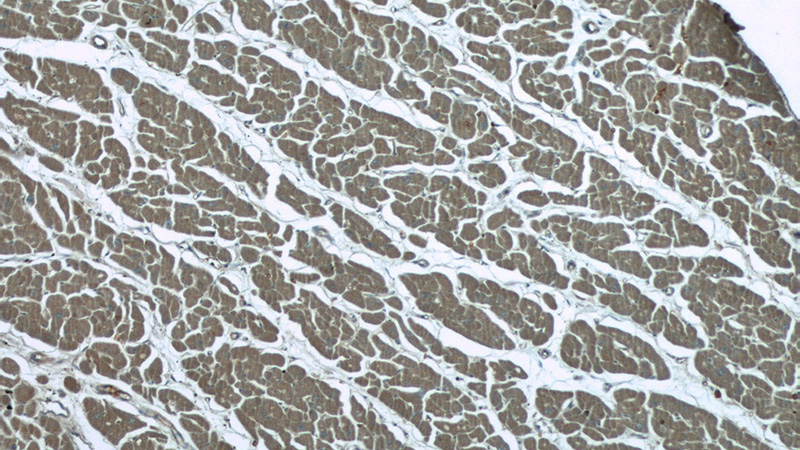 Immunohistochemistry of paraffin-embedded human heart tissue slide using Catalog No:111985(KIAA0774 Antibody) at dilution of 1:50 (under 40x lens)