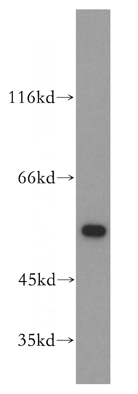 Jurkat cells were subjected to SDS PAGE followed by western blot with Catalog No:111177(GSR antibody) at dilution of 1:500