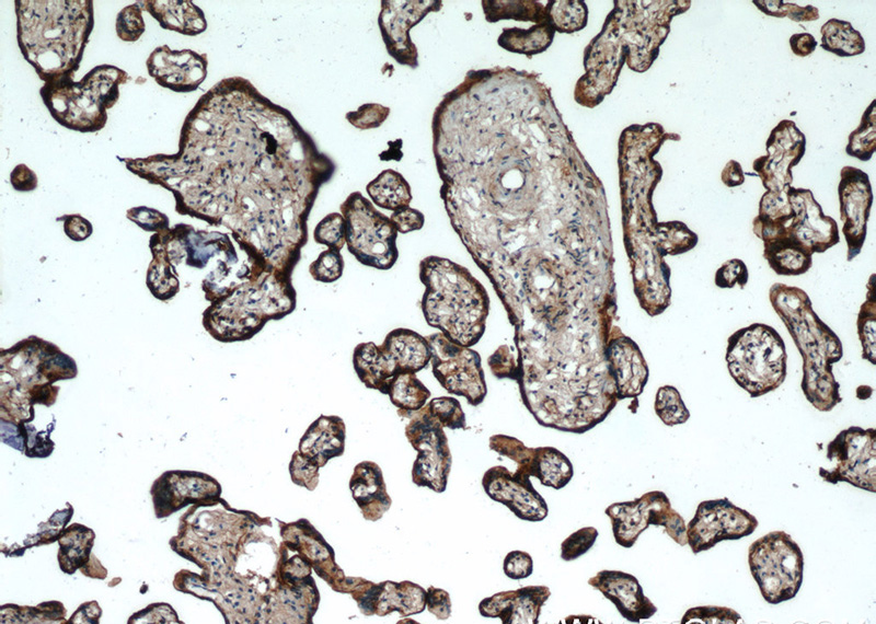Immunohistochemistry of paraffin-embedded human placenta tissue slide using Catalog No:107143(CD71 Antibody) at dilution of 1:200 (under 10x lens)