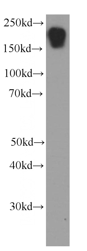 human skeletal muscle tissue were subjected to SDS PAGE followed by western blot with Catalog No:107318(Myosin 2a Antibody) at dilution of 1:4000