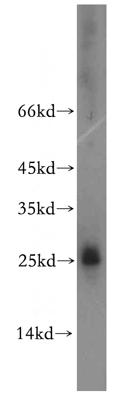 human testis tissue were subjected to SDS PAGE followed by western blot with Catalog No:111482(HMGB4 antibody) at dilution of 1:300