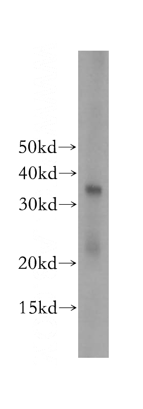 Sp2/0 cells were subjected to SDS PAGE followed by western blot with Catalog No:115897(SII-TFIIS,TCEA1 antibody) at dilution of 1:800