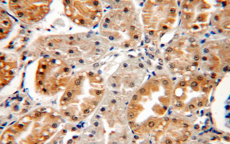 Immunohistochemical of paraffin-embedded human kidney using Catalog No:114364(PTK2B antibody) at dilution of 1:100 (under 40x lens)