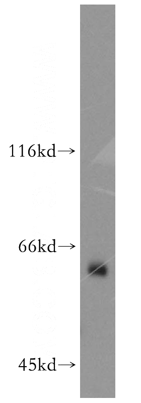 A431 cells were subjected to SDS PAGE followed by western blot with Catalog No:116234(TRAF6 antibody) at dilution of 1:300
