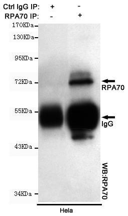 Immunoprecipitation analysis of Hela cell lysates using RPA70 mouse mAb.
