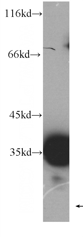Raji cells were subjected to SDS PAGE followed by western blot with Catalog No:107050(MS4A1,CD20 antibody) at dilution of 1:1000