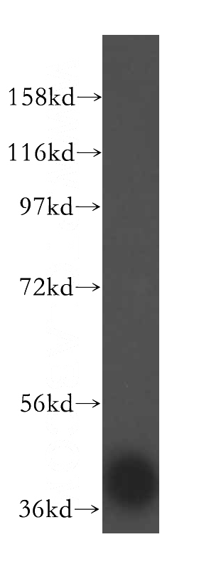 HepG2 cells were subjected to SDS PAGE followed by western blot with Catalog No:108258(ADPRHL2 antibody) at dilution of 1:500