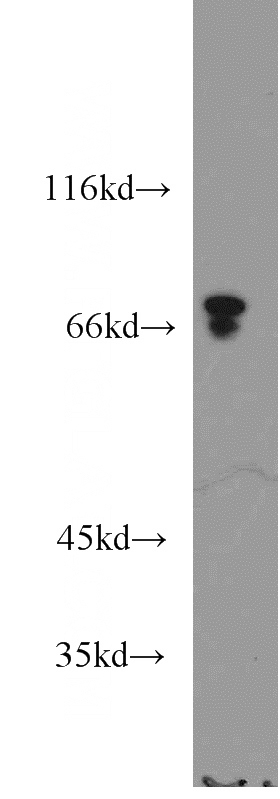 mouse kidney tissue were subjected to SDS PAGE followed by western blot with Catalog No:107702(ACSS1 antibody) at dilution of 1:3000