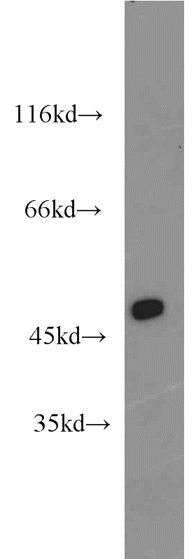 human heart tissue were subjected to SDS PAGE followed by western blot with Catalog No:112990(MYOD1 antibody) at dilution of 1:2000