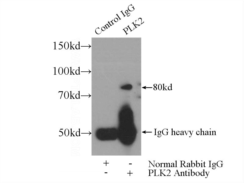 IP Result of anti-PLK2 (IP:Catalog No:113969, 4ug; Detection:Catalog No:113969 1:300) with HeLa cells lysate 2480ug.