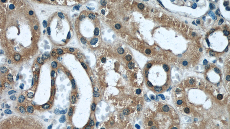 Immunohistochemical of paraffin-embedded human kidney using Catalog No:110047(DocK8 antibody) at dilution of 1:50 (under 40x lens)