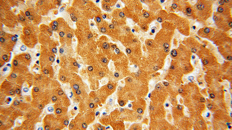 Immunohistochemical of paraffin-embedded human liver using Catalog No:115362(SLC27A2 antibody) at dilution of 1:50 (under 40x lens)