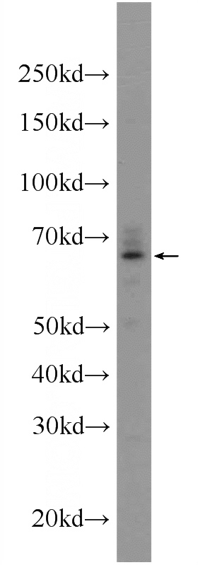 HepG2 cells were subjected to SDS PAGE followed by western blot with Catalog No:112137(KTELC1 Antibody) at dilution of 1:600