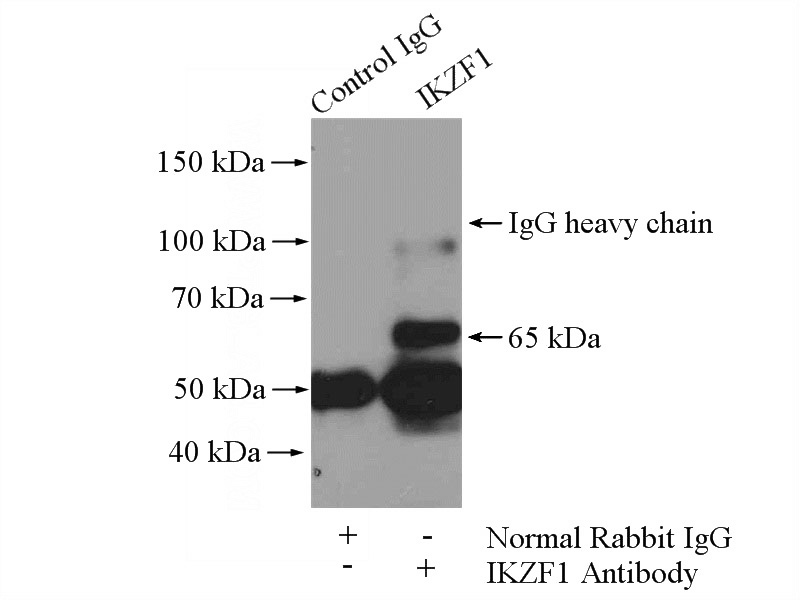 IP Result of anti-IKZF1 (IP:Catalog No:111647, 4ug; Detection:Catalog No:111647 1:500) with HeLa cells lysate 1200ug.