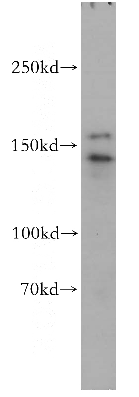 Jurkat cells were subjected to SDS PAGE followed by western blot with Catalog No:111489(HMHA1 antibody) at dilution of 1:800