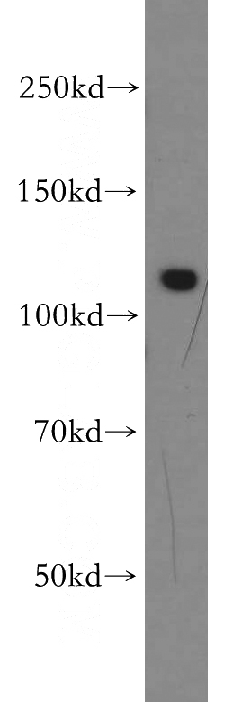 mouse testis tissue were subjected to SDS PAGE followed by western blot with Catalog No:115174(SGSM1 antibody) at dilution of 1:500