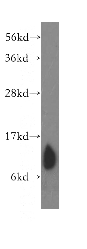 human skeletal muscle tissue were subjected to SDS PAGE followed by western blot with Catalog No:109500(COX7B antibody) at dilution of 1:400