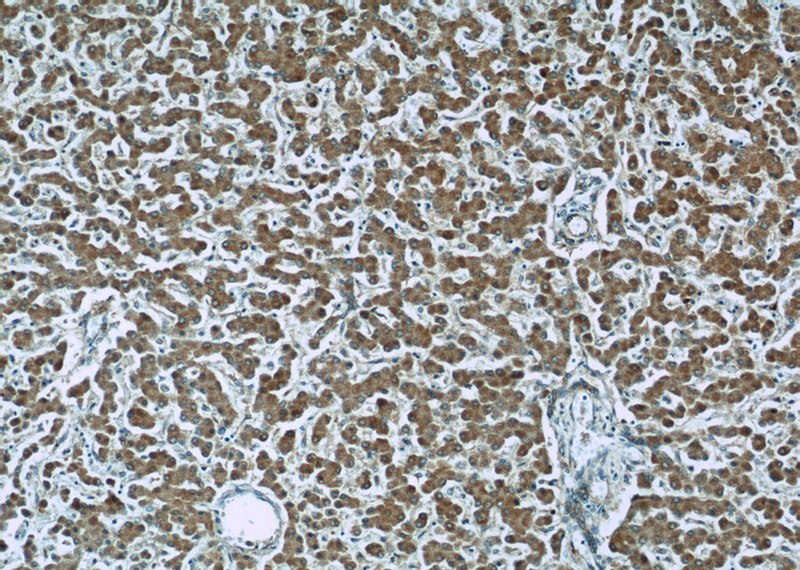Immunohistochemistry of paraffin-embedded human liver slide using Catalog No:113050(ND1 Antibody) at dilution of 1:50