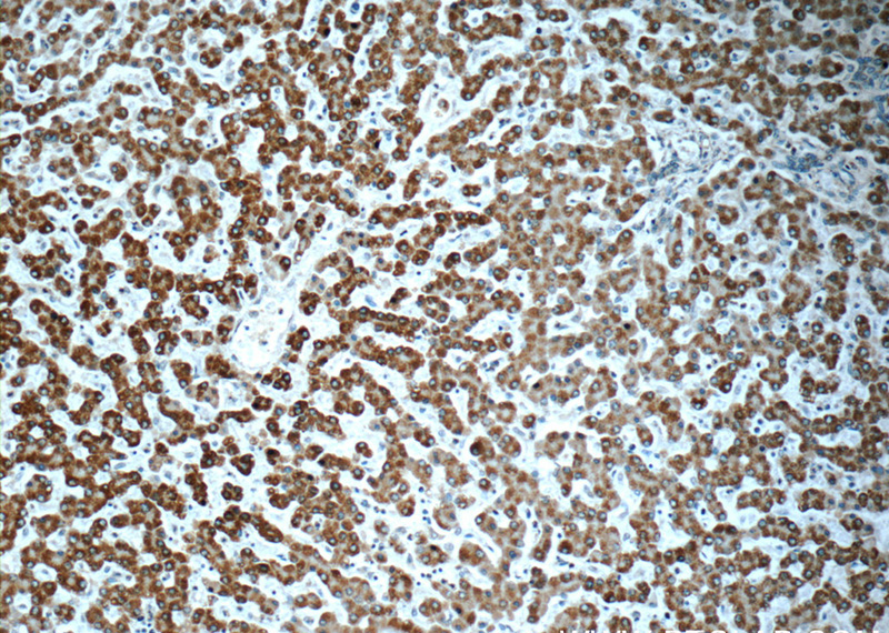 Immunohistochemistry of paraffin-embedded human liver slide using Catalog No:107565(AK2 Antibody) at dilution of 1:50