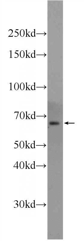 HepG2 cells were subjected to SDS PAGE followed by western blot with Catalog No:111756(ILVBL Antibody) at dilution of 1:1000