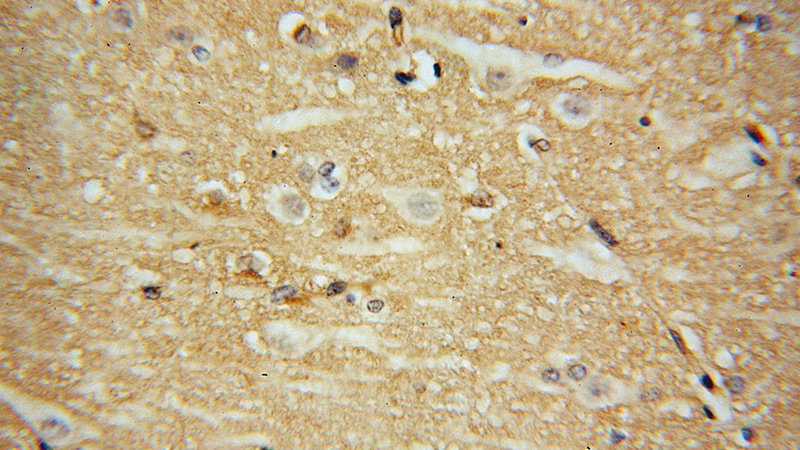 Immunohistochemical of paraffin-embedded human brain using Catalog No:113228(NQO2 antibody) at dilution of 1:100 (under 40x lens)