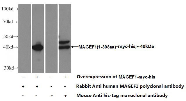Transfected HEK-293 cells were subjected to SDS PAGE followed by western blot with Catalog No:112452 (MAGEF1 Antibody) at dilution of 1:1000