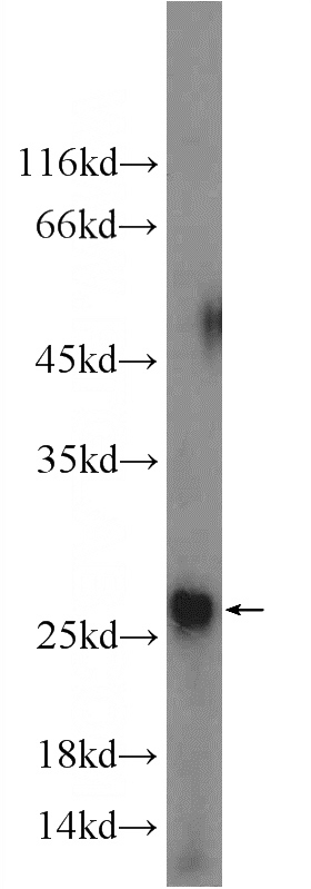 PC-3 cells were subjected to SDS PAGE followed by western blot with Catalog No:108076(ANKRD39 Antibody) at dilution of 1:300