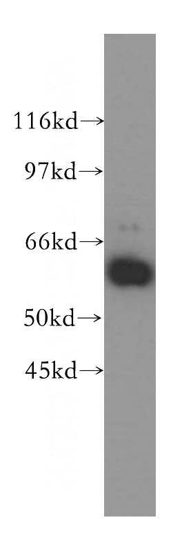 HeLa cells were subjected to SDS PAGE followed by western blot with Catalog No:113551(P4HA2 antibody) at dilution of 1:500