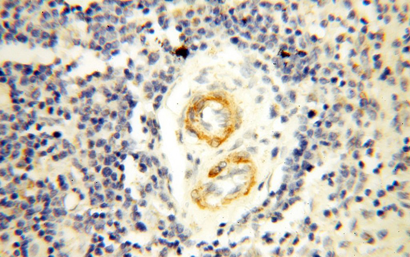 Immunohistochemical of paraffin-embedded human spleen using Catalog No:110930(GDPD5 antibody) at dilution of 1:50 (under 40x lens)