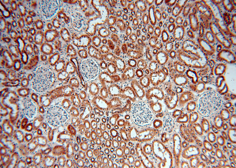 Immunohistochemical of paraffin-embedded human kidney using Catalog No:109221(CHD9 antibody) at dilution of 1:100 (under 10x lens)