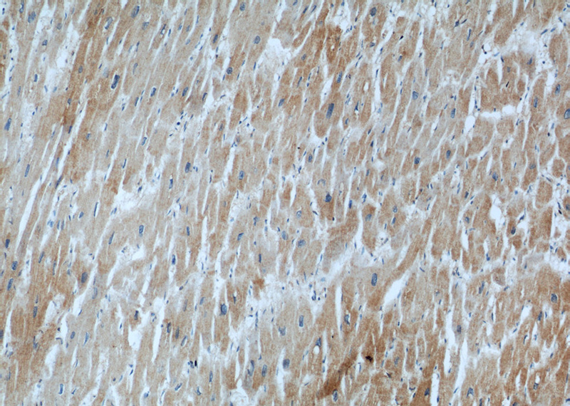 Immunohistochemistry of paraffin-embedded human heart slide using Catalog No:107175(CKM-Specific Antibody) at dilution of 1:50