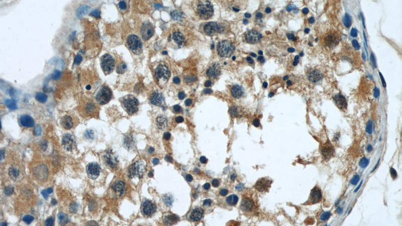 Immunohistochemical of paraffin-embedded human testis using Catalog No:108788(C7orf30 antibody) at dilution of 1:50 (under 40x lens)