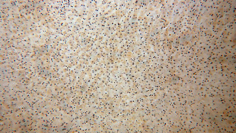 Immunohistochemical of paraffin-embedded human liver using Catalog No:114829(RPS14 antibody) at dilution of 1:200 (under 10x lens)