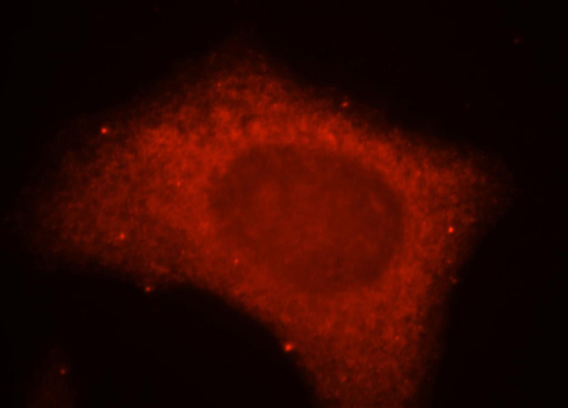 Immunofluorescent analysis of MCF-7 cells, using KISS1R antibody Catalog No:112072 at 1:25 dilution and Rhodamine-labeled goat anti-rabbit IgG (red).