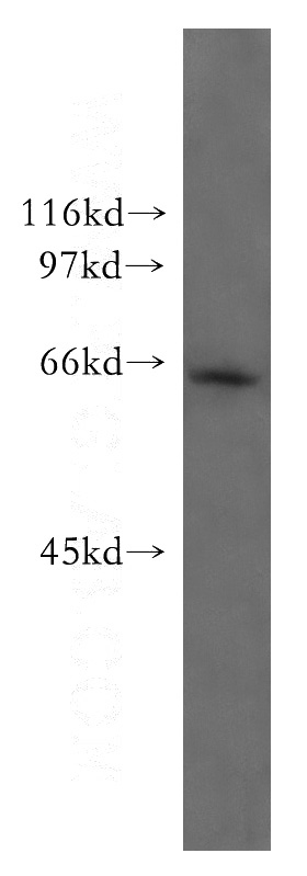 mouse skeletal muscle tissue were subjected to SDS PAGE followed by western blot with Catalog No:112579(Mecr antibody) at dilution of 1:1000