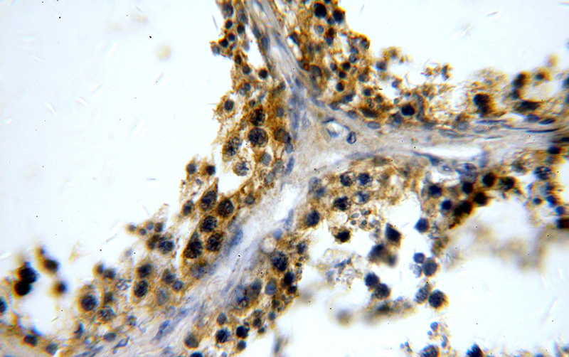 Immunohistochemical of paraffin-embedded human testis using Catalog No:114871(RUNDC3A antibody) at dilution of 1:100 (under 40x lens)