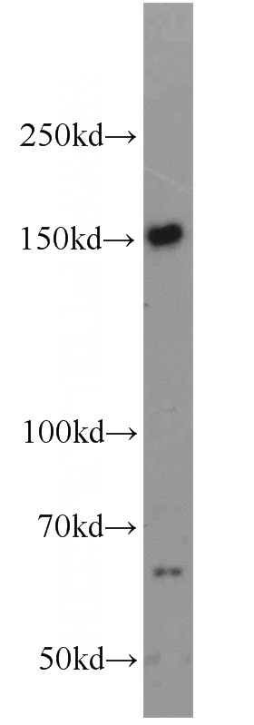 HEK-293 cells were subjected to SDS PAGE followed by western blot with Catalog No:114172(PRDM10 antibody) at dilution of 1:1000
