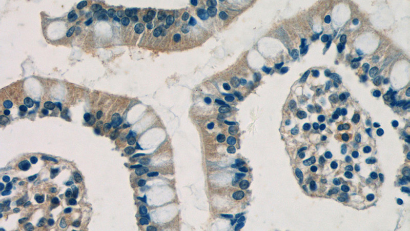 Immunohistochemistry of paraffin-embedded human small intestine tissue slide using Catalog No:115264(SHARPIN Antibody) at dilution of 1:50 (under 40x lens)