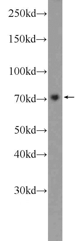 MCF-7 cells were subjected to SDS PAGE followed by western blot with Catalog No:110768(GAB2 Antibody) at dilution of 1:600