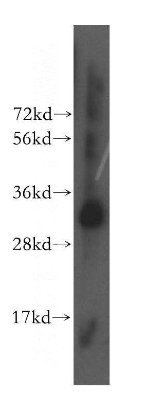 human heart tissue were subjected to SDS PAGE followed by western blot with Catalog No:112830(MRPL46 antibody) at dilution of 1:300