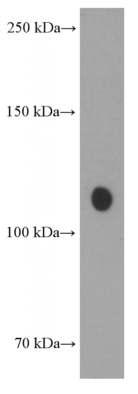 NIH/3T3 cells were subjected to SDS PAGE followed by western blot with Catalog No:107643(TRIM24 Antibody) at dilution of 1:1000
