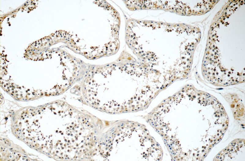Immunohistochemistry of paraffin-embedded human testis tissue slide using Catalog No:115229(SIK1 Antibody) at dilution of 1:50 (under 10x lens)