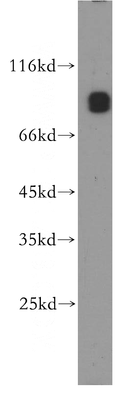 K-562 cells were subjected to SDS PAGE followed by western blot with Catalog No:109429(CNNM3 antibody) at dilution of 1:500