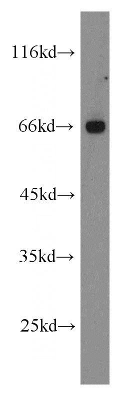 Jurkat cells were subjected to SDS PAGE followed by western blot with Catalog No:110519(FANCG antibody) at dilution of 1:100