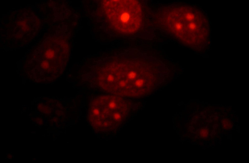 Immunofluorescent analysis of HepG2 cells, using POP1 antibody Catalog No:114060 at 1:25 dilution and Rhodamine-labeled goat anti-rabbit IgG (red).