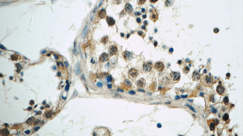 Immunohistochemistry of paraffin-embedded human testis tissue slide using Catalog No:116432(TSGA14 Antibody) at dilution of 1:50 (under 40x lens)