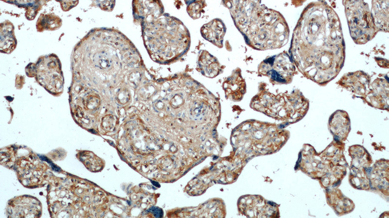 Immunohistochemical of paraffin-embedded human placenta using Catalog No:107582(AMOT antibody) at dilution of 1:100 (under 10x lens)